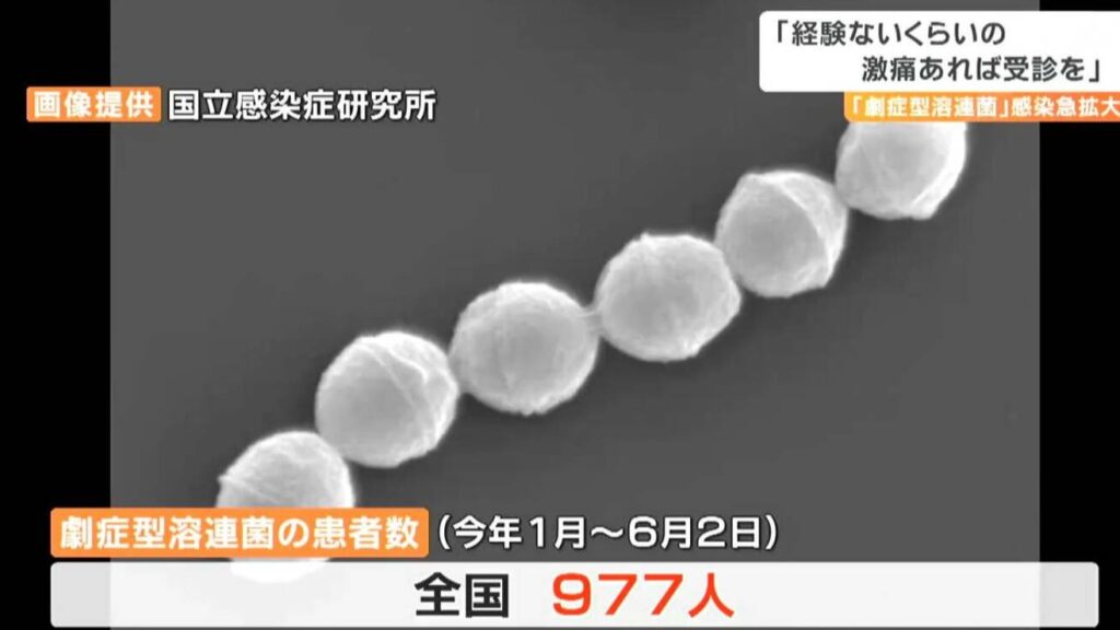 什么是食人菌？去日本旅行该如何防范？赴日前你一定要知道的注意事项